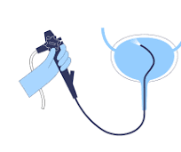cystoscopy